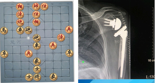 IMG 20251127 220918.jpg