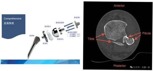 IMG 20251128 224353.jpg