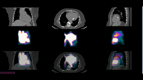 HzQDisRhpX bI g1.jpg