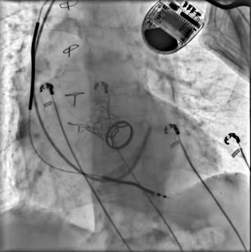 KZqKUVwd4AB K wz.jpg