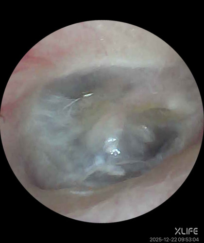 processed B8803E81 9A1C 4FE6 951B 735097848CA9.jpg