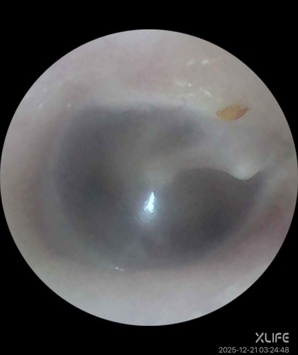 processed 13E1711F 8F91 47F8 80E1 80B07FEB798D.jpg