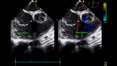  bhAnM1sfeiEIG7L.jpg