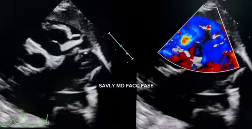 HyMwn XEyy6t2S S.jpg