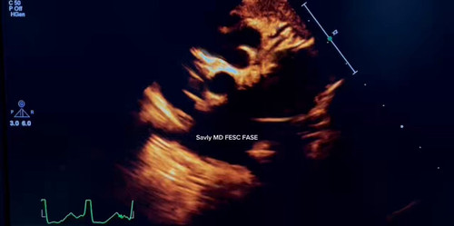 BtphJH 62p5jmXMQ.jpg