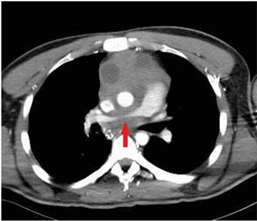 G8vouxsa0AEk78 ?format=jpg.jpg