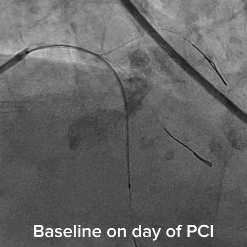 U0kThgXVi 7pVPXS.jpg