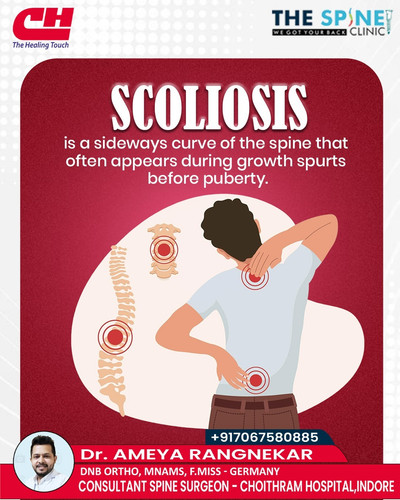 Scoliosis Correction in Indore Dr Ameya Rangnekar.jpg