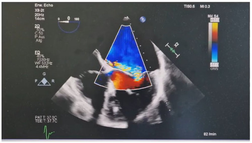 G8mvoNpWoAAyrqR?format=jpg.jpg