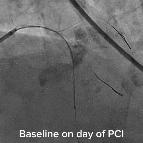 hmygmWTMXf0e35 C.jpg