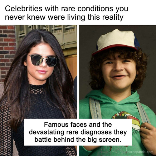 Celebrities with rare conditions.jpg