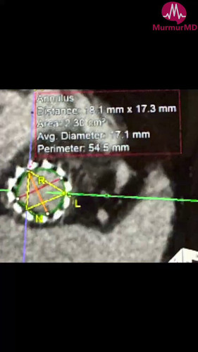 lr634 zl4ywP4qG7.jpg