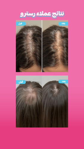 قبل و بعد 2.jpg