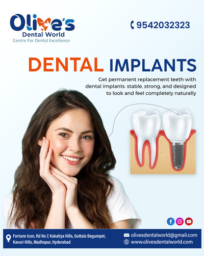 Why Dental Implants Last Longer Than Other Tooth Replacements?.jpg