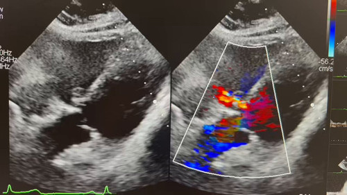 Q6sxTBhe 2ET1o 0.jpg