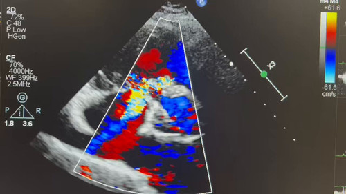 SFAH VfU0Oz BMZh.jpg