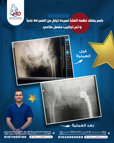 محمد ضياء قبل وبعد[1]2.png