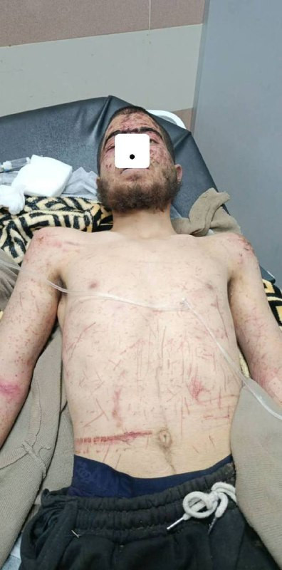 في منطقة غرب رام الله، وقعت حادثة خطيرة حيث تم اختطاف الشاب اويس همام ذيب (20 عامًا) من قرية خربثا بني حارث على يد عصابات المستوطنين أمس الأربعاء، من ...