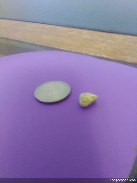Kidney Stone Next To A Quarter 6 2 22.jpg
