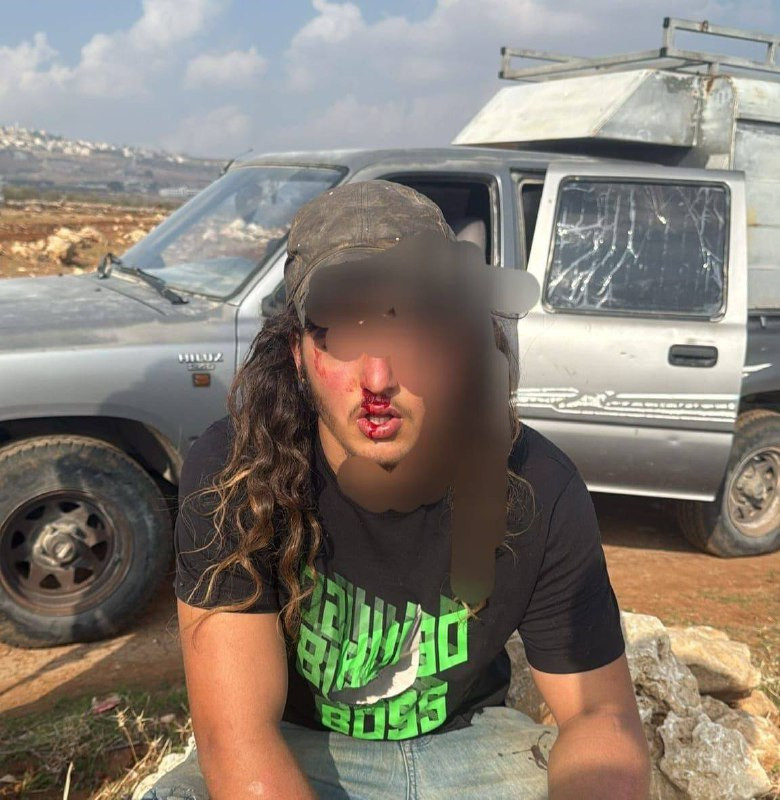 صورة | إصابة مستوطن خلال تصدي الأهالي لهجوم مليشيات المستوطنين على بلدة دير دبوان شمال شرق رام الله....