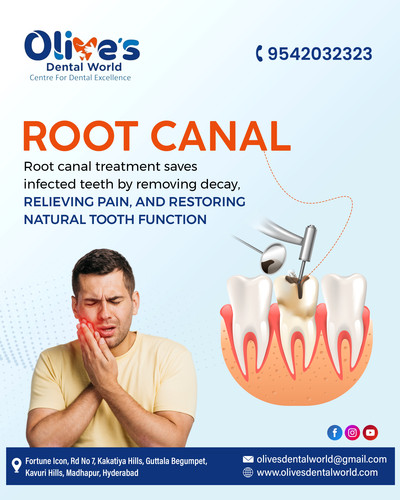 Why Root Canal Treatment Is a Safe and Effective Dental Procedure?.jpg