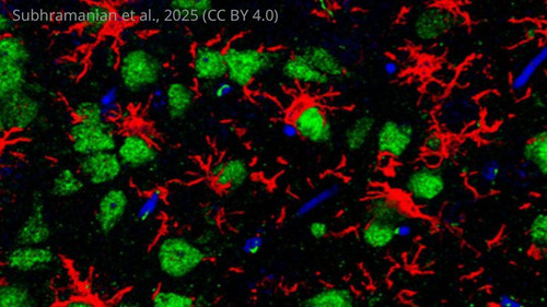 G ai4XrXIAAZ4U2?format=jpg.jpg