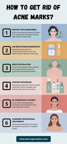 A Step-by-Step Guide to Fading Acne Marks.jpg