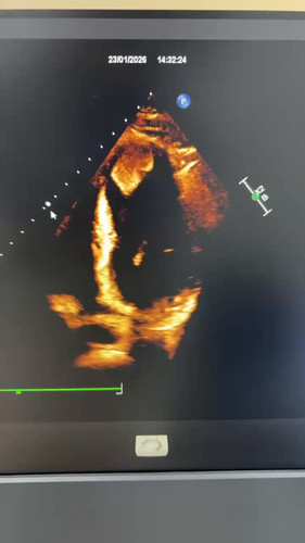 Xih sl1 gTBSJ 0W.jpg