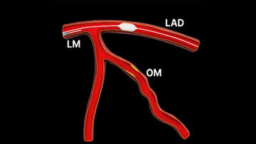 G gRkCfXYAA0cwp?format=png.png