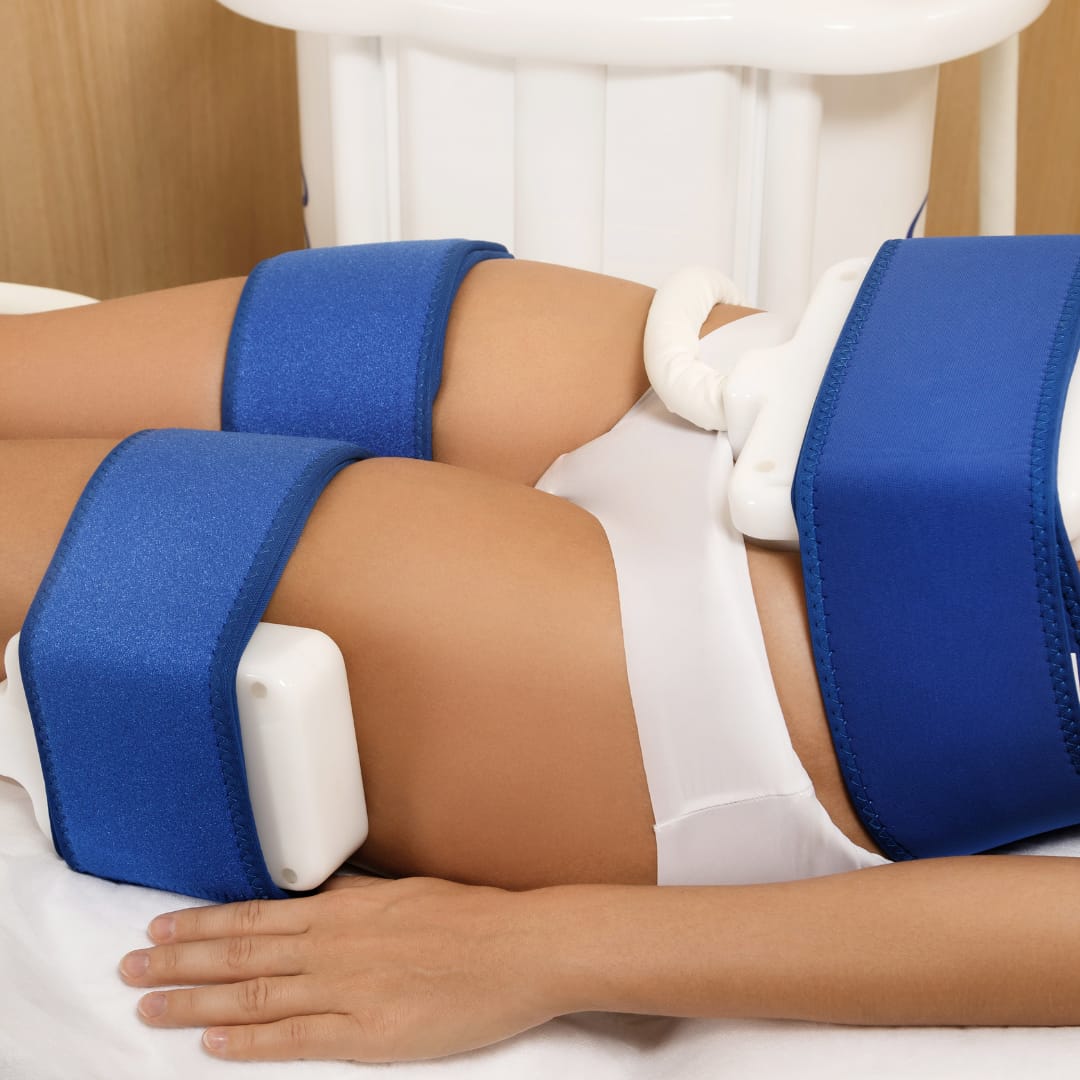 Criolipólise de Placas em Vitória