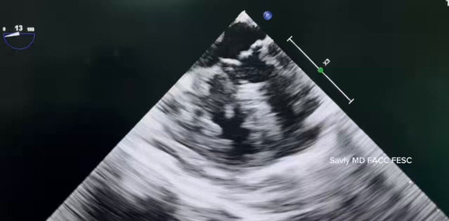 ttp9r kmw18VSGnm.jpg