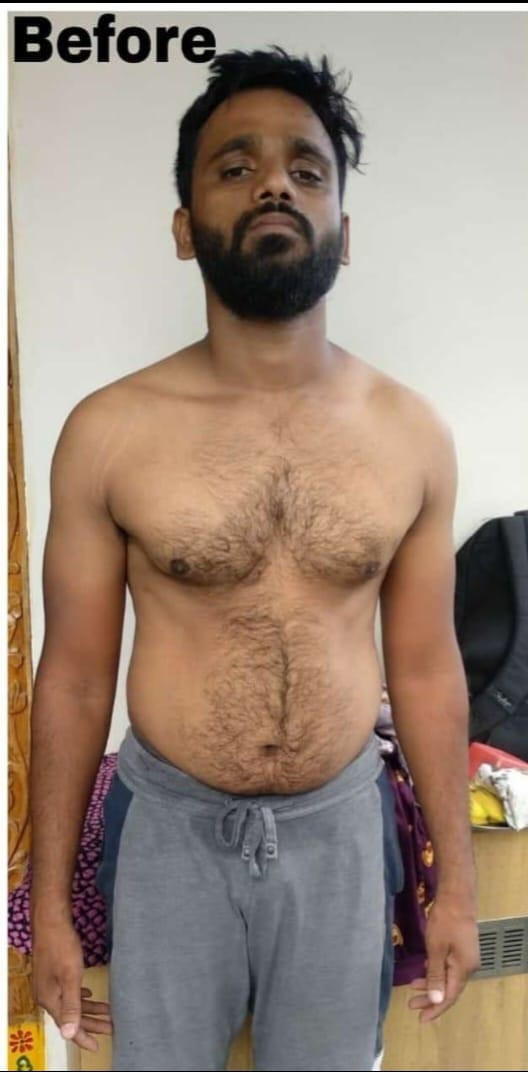 Before transformation - Weight loss journey