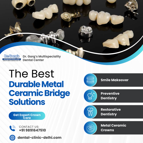 Dr. Garg’s Multispeciality Dental Center Offers Durable Metal Ceramic Bridge Solutions.png