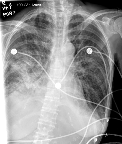 G qD69IaUAAbT70?format=png.png