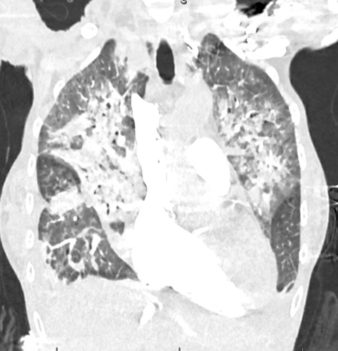 G qFPQxa8AAVeJ ?format=png.png