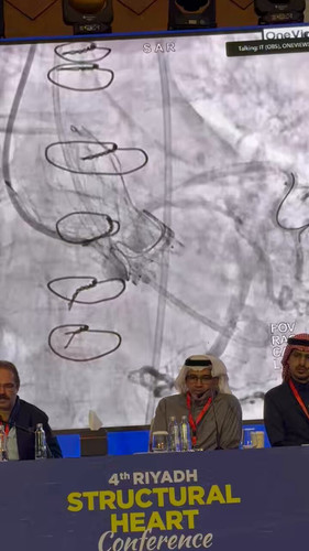 VdVa2w9ZX Dt1HvK.jpg