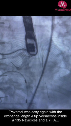 eexUpJLvq3lzj 9L.jpg