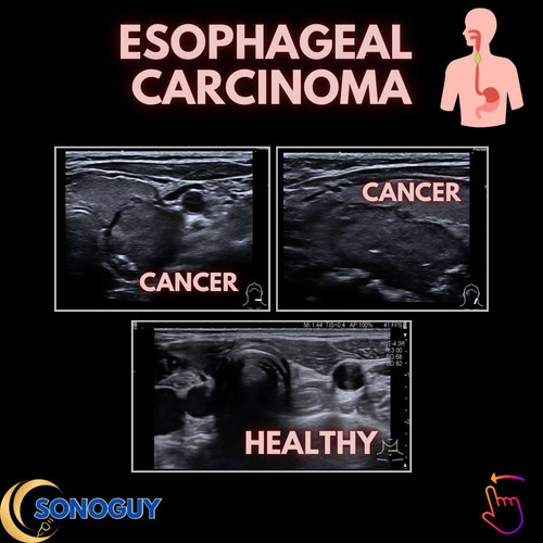 G pb5fpbgAEiHDv?format=jpg.jpg