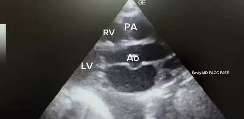 Tog1vVVEU3tFR6d .jpg