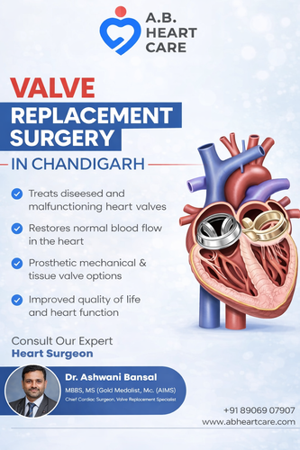 Valve replacement surgery in Chandigarh.png