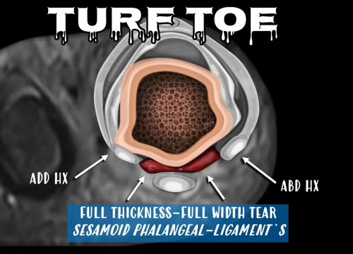 GostMwMEmuadS Qg.jpg