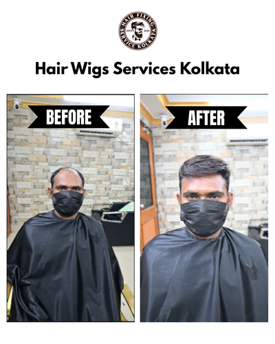 Hair Wigs Services Kolkata -Hair Fixing Service Kolkata.png