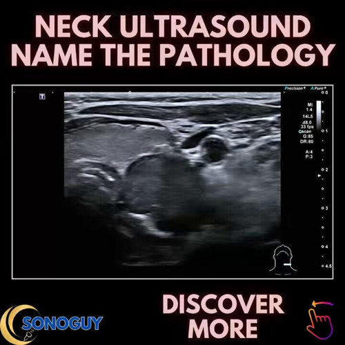 O NdCuXQXBDb7B17.jpg