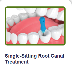 single sitting root canal treatment.png
