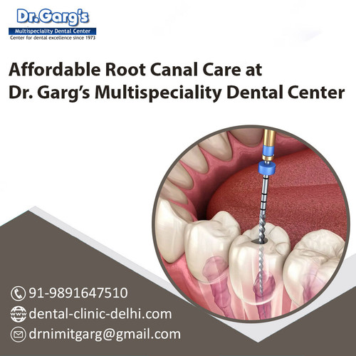 Affordable Root Canal Care at Dr. Garg’s Multispeciality Dental Center.jpg