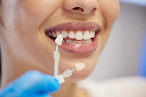 Dental veneers are a popular cosmetic dentistry solution for patients in Park Ridge who want to improve the appearance of their smile. Veneers are thin, custom-made shells designed to cover the front surface of teeth, enhancing their color, shape, size, and alignment.

Learn More- https://dentistinparkridge.com/veneers/