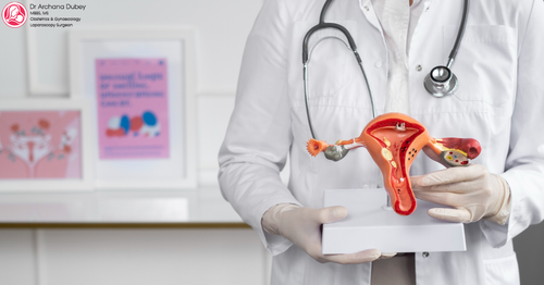 Adenomyosis Treatment 5.png