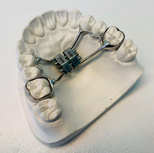 Несъёмный ортодонтический аппарат ХААС.jpg