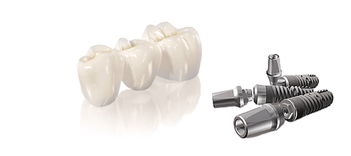 Установить временную коронку на имплант в Москве.png