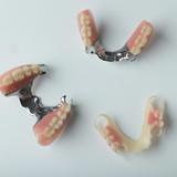 Поставить бюгельный протез на замках в Москве